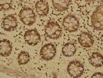 MTM1 Antibody in Immunohistochemistry (Paraffin) (IHC (P))
