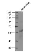 MTM1 Antibody in Western Blot (WB)