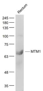 MTM1 Antibody in Western Blot (WB)