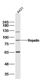 Repetin Antibody in Western Blot (WB)