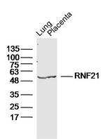 RNF21 Antibody in Western Blot (WB)
