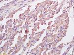RNF123 Antibody in Immunohistochemistry (Paraffin) (IHC (P))