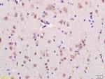 RNF123 Antibody in Immunohistochemistry (Paraffin) (IHC (P))