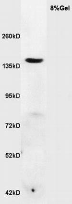 RNF123 Antibody in Western Blot (WB)