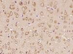 RNF170 Antibody in Immunohistochemistry (Paraffin) (IHC (P))