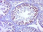 BTBD1 Antibody in Immunohistochemistry (Paraffin) (IHC (P))