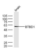 BTBD1 Antibody in Western Blot (WB)
