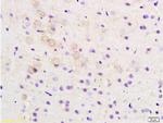 ARHGAP32 Antibody in Immunohistochemistry (Paraffin) (IHC (P))