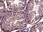 RanBP1 Antibody in Immunohistochemistry (Paraffin) (IHC (P))
