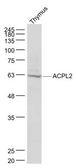 ACPL2 Antibody in Western Blot (WB)