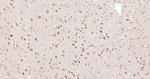 ANKRD33B Antibody in Immunohistochemistry (Paraffin) (IHC (P))