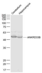 ANKRD33B Antibody in Western Blot (WB)