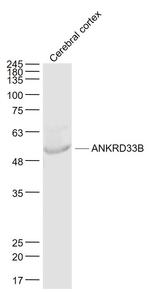 ANKRD33B Antibody in Western Blot (WB)