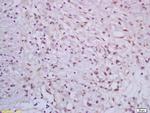 CRSP complex subunit 7/ARC70 Antibody in Immunohistochemistry (Paraffin) (IHC (P))