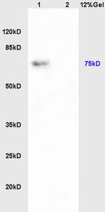 PAPOL A+B+G Antibody in Western Blot (WB)
