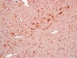 BBS5 Antibody in Immunohistochemistry (Paraffin) (IHC (P))