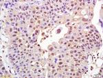 FOXO1A Antibody in Immunohistochemistry (Paraffin) (IHC (P))