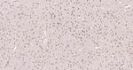 FOXO1A Antibody in Immunohistochemistry (Paraffin) (IHC (P))