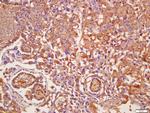 AMPK gamma 1/2/3 Antibody in Immunohistochemistry (Paraffin) (IHC (P))