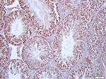 Protein S Antibody in Immunohistochemistry (Paraffin) (IHC (P))