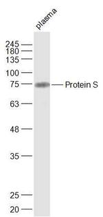 Protein S Antibody in Western Blot (WB)