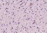 C6orf120 Antibody in Immunohistochemistry (Paraffin) (IHC (P))