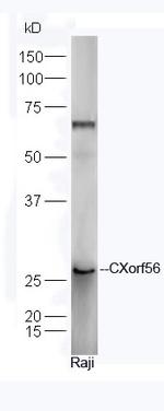 CXorf56 Antibody in Western Blot (WB)