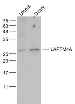 LAPTM4A Antibody in Western Blot (WB)