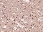 STAT1 p84/p91 Antibody in Immunohistochemistry (Paraffin) (IHC (P))