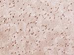 STAT1 p84/p91 Antibody in Immunohistochemistry (Paraffin) (IHC (P))