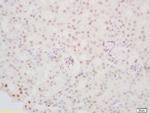 PINX-1 Antibody in Immunohistochemistry (Paraffin) (IHC (P))