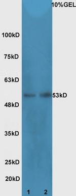 Cdc25C Antibody in Western Blot (WB)