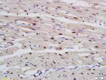 RBM20 Antibody in Immunohistochemistry (Paraffin) (IHC (P))