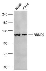 RBM20 Antibody in Western Blot (WB)