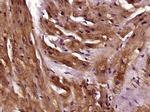 TPM1/2/3/4 Antibody in Immunohistochemistry (Paraffin) (IHC (P))