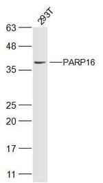 PARP16 Antibody in Western Blot (WB)