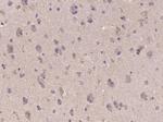 IDH1 Antibody in Immunohistochemistry (Paraffin) (IHC (P))