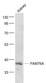 FAM76A Antibody in Western Blot (WB)