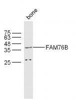 FAM76B Antibody in Western Blot (WB)