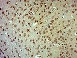 CGI62/C8orf70 Antibody in Immunohistochemistry (Paraffin) (IHC (P))