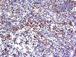 HECA Antibody in Immunohistochemistry (Paraffin) (IHC (P))