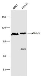 ANKMY1 Antibody in Western Blot (WB)