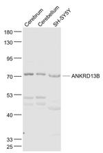 ANKRD13B Antibody in Western Blot (WB)