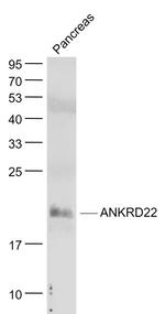 ANKRD22 Antibody in Western Blot (WB)
