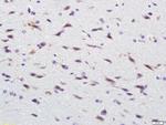 EGFR5 Antibody in Immunohistochemistry (Paraffin) (IHC (P))