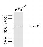 EGFR5 Antibody in Western Blot (WB)