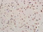 RNF213 Antibody in Immunohistochemistry (Paraffin) (IHC (P))