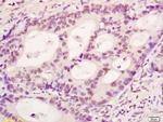 Phospho-LEF1 (Ser42) Antibody in Immunohistochemistry (Paraffin) (IHC (P))