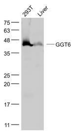 GGT6 Antibody in Western Blot (WB)