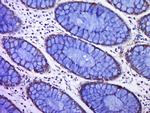 C12ORF42 Antibody in Immunohistochemistry (Paraffin) (IHC (P))